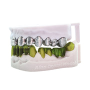 Alias Dental Döküm Reçinesi